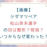 [画像]シダマツペア松山奈未選手の目は整形？怪我？いつからなぜ変わった？